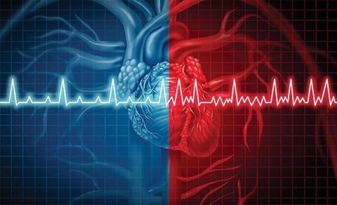 Busting Atrial Fibrillation Myths