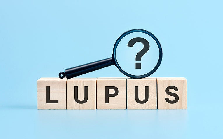 Lupus (Systemic Lupus Erythematosus): What It Is, Symptoms and Who is at Risk