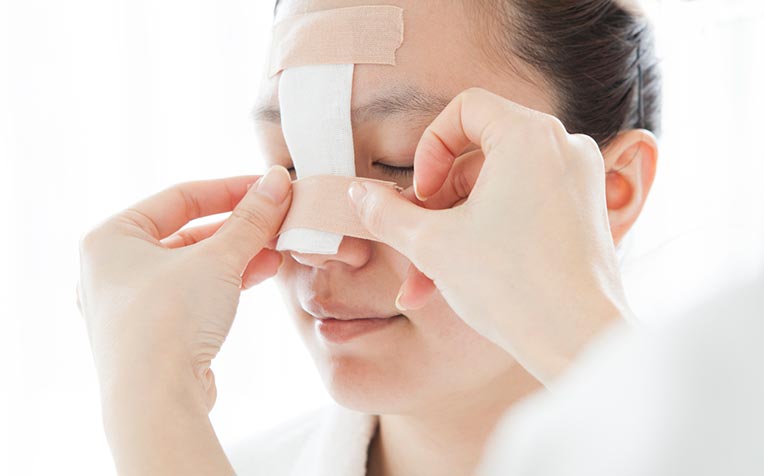 Broken Nose Diagnosis and Treatment