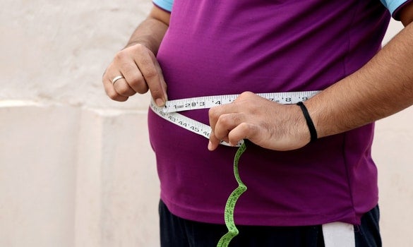 Endoscopic Weight Loss Treatments for Obesity - SGH