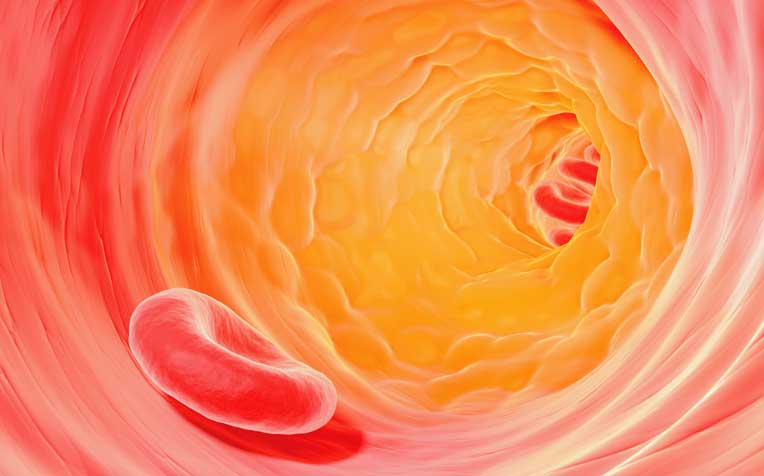 Sudden Cardiac Death Risk Factors: Coronary Artery Disease, Family History, and More