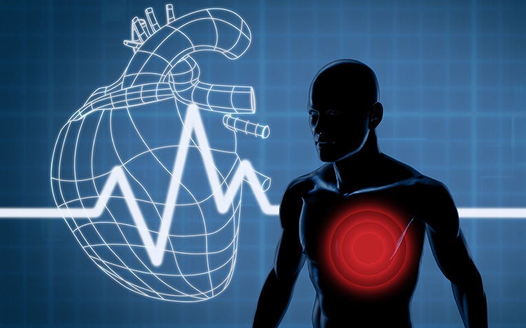 Atrial Fibrillation: What are the risk factors?