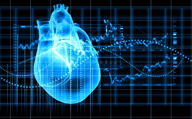 Marfan Syndrome: What is it?