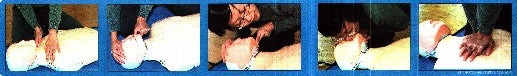 steps of cardio-pulmonary resuscitation (CPR)