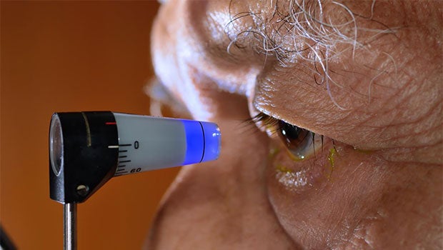 Singapore-led study found glaucoma preventing gene mutation