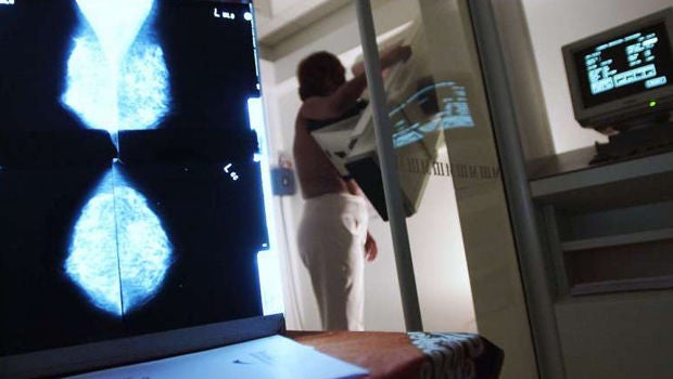 Breast, prostate cancers rising sharply in Singapore