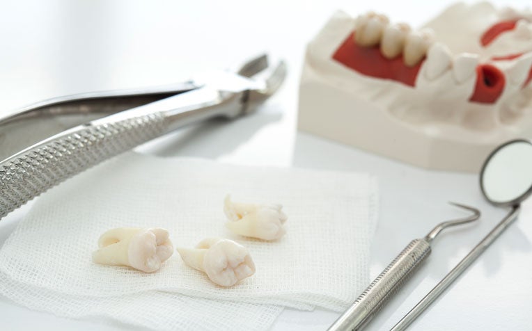 Diabetes and Teeth: FAQ on Wisdom Teeth, Dentures and More