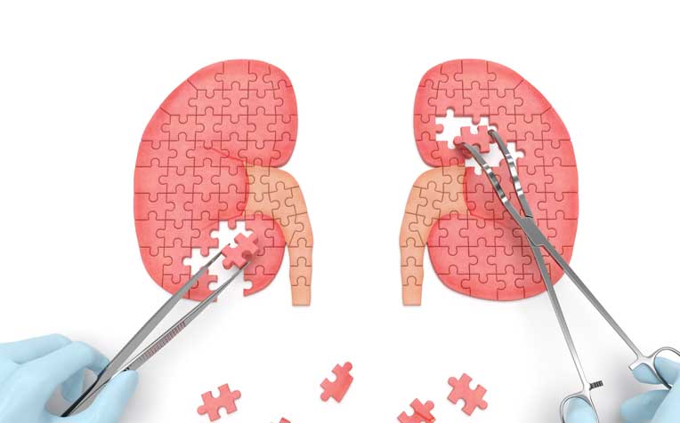 ​​Kidney Cancer in Singapore: Stats and Treatment