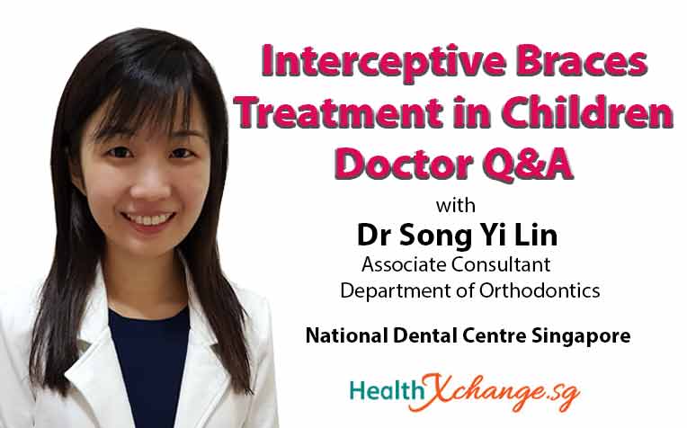 Interceptive Braces Treatment in Children Doctor Q&A
