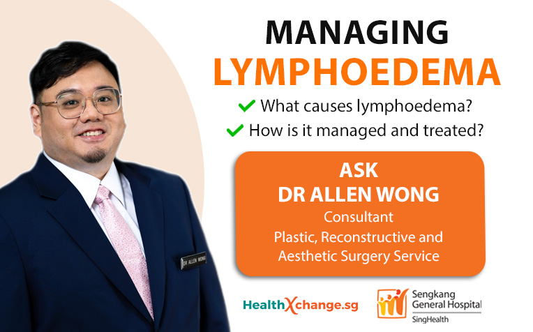 Lymphoedema (Lymphedema) - Doctor Q&A