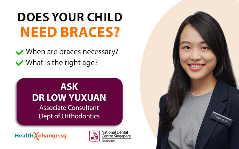  ​Braces for Children - Doctor Q&A 