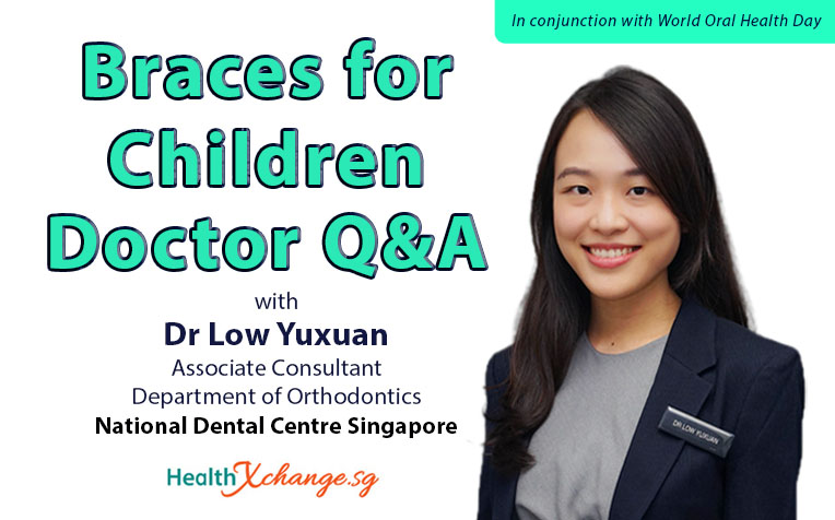  ​Braces for Children - Doctor Q&A 