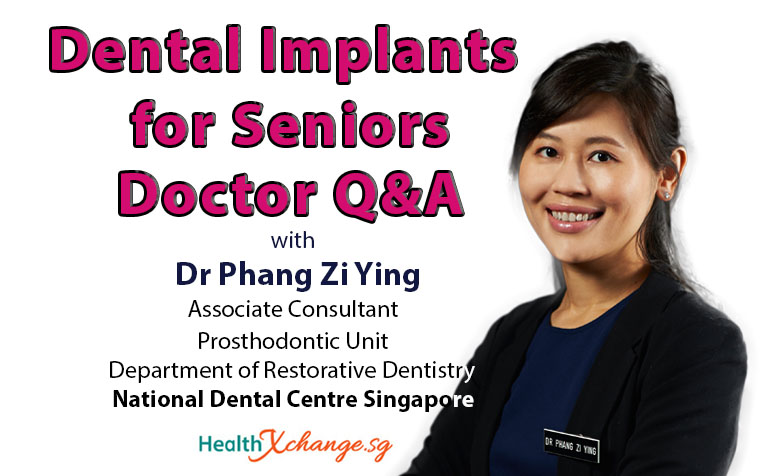  ​Dental Implants for Seniors - Doctor Q&A