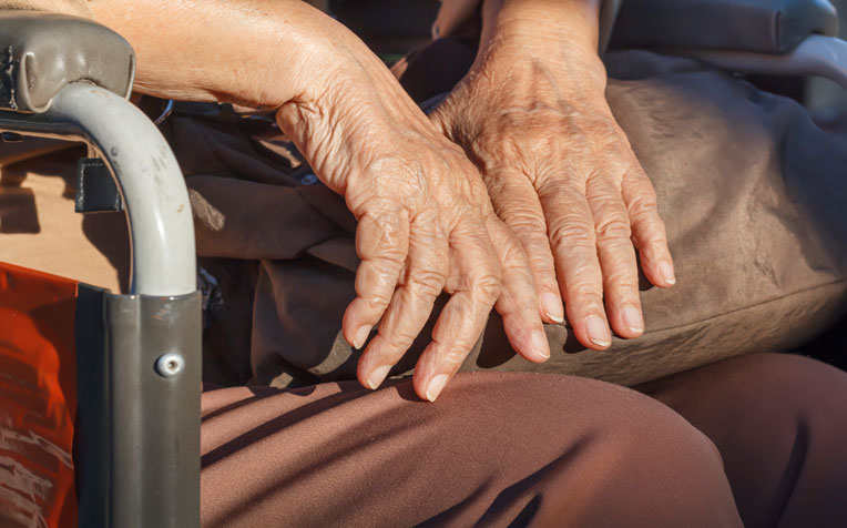 ​Parkinson Disease - Doctor Q&A​