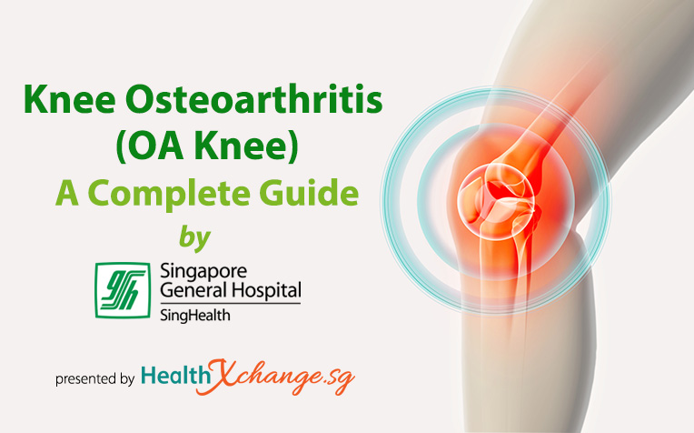  ​Knee Osteoarthritis (OA Knee) A Complete Guide