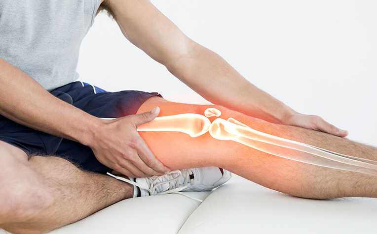 Common Knee Injuries: Knee Osteoarthritis