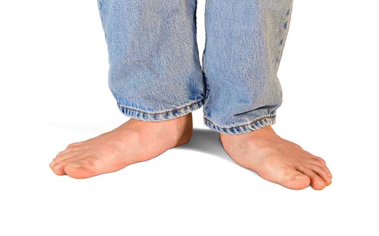 Flat Foot: An Essential Guide