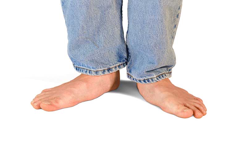 flat foot remedies