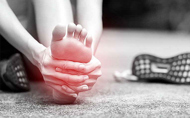 Plantar Fasciitis (Heel Pain): How to Manage