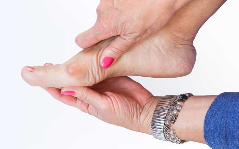 /sites/hexassets/Assets/bones-joints/how-to-treat-foot-bunions.jpg