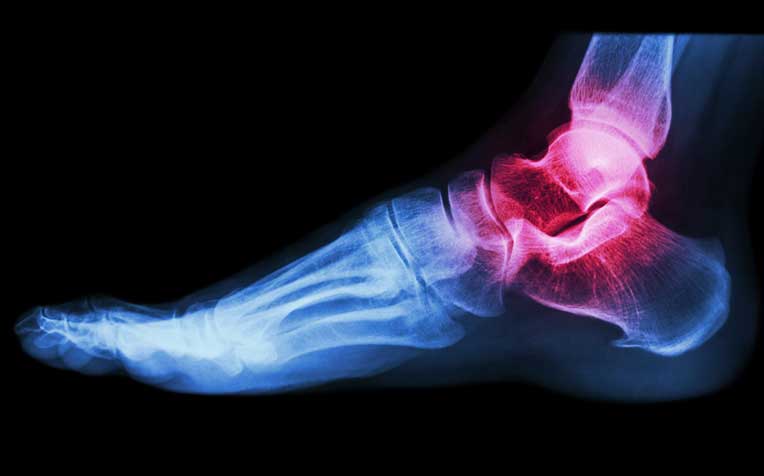  ​​Common Foot and Ankle Problems