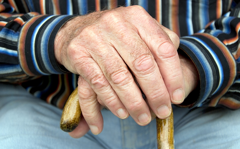  ​Osteoarthritis What You Need To Know
