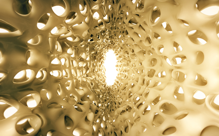  ​Osteoporosis Are You at Risk?