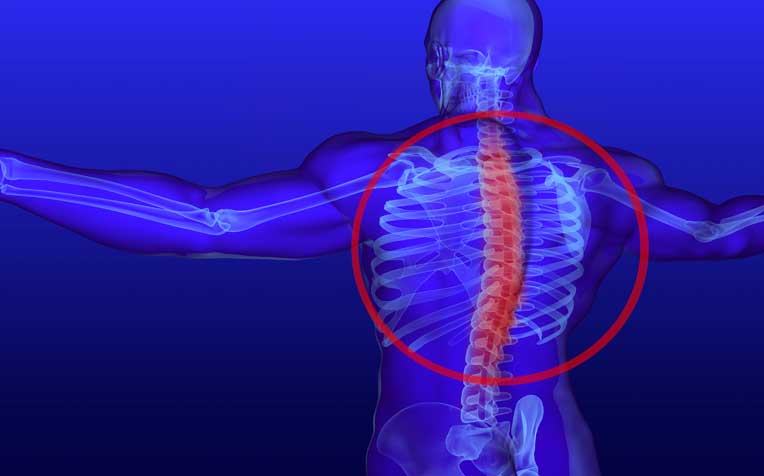 /sites/hexassets/Assets/bones-joints/scoliosis-a-machine-helps-patients-breathe-properly.jpg