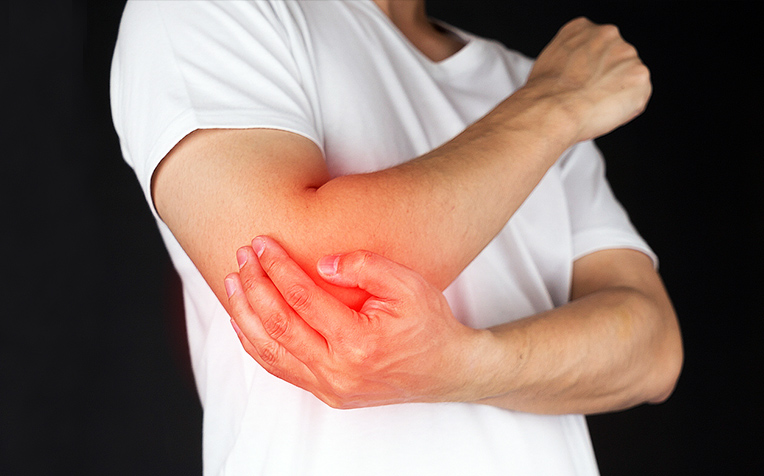 ​Tennis Elbow How to Prevent and Manage 