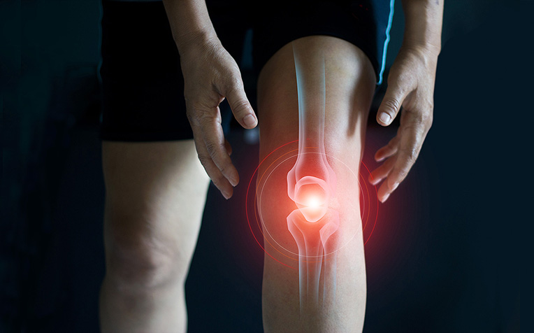 /sites/hexassets/Assets/bones-joints/what-is-knee-osteoarthritis-oa-knee.jpg