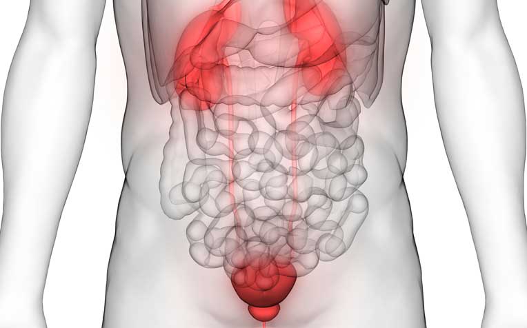 Bladder Cancer: Causes and Types