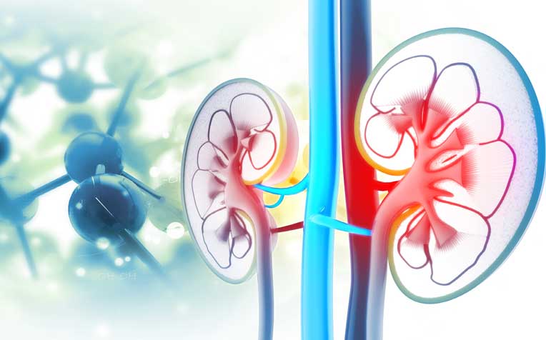 Kidney Cancer: Diagnosis and Treatments