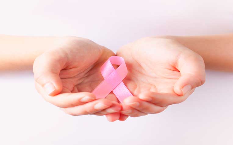  How to Prevent Breast Cancer 