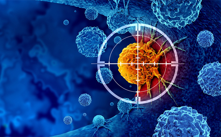 Prostate Cancer Treatment: What to Expect