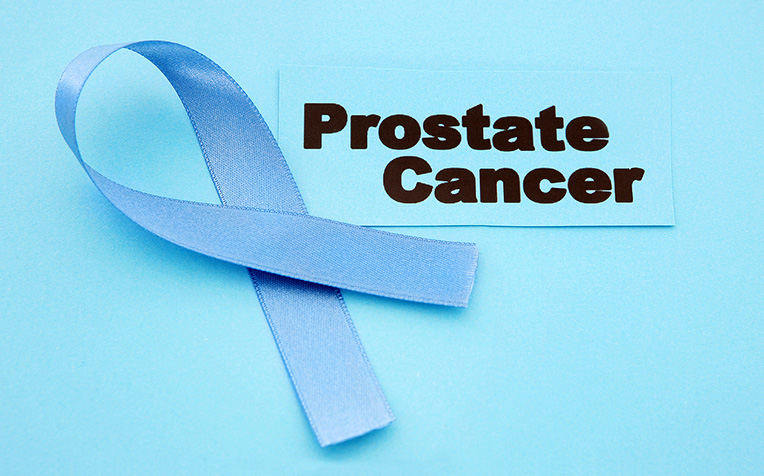 Prostate Cancer How to Prevent
