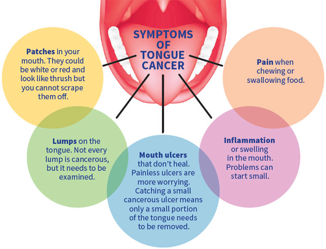 Symptoms of Tongue Cancer