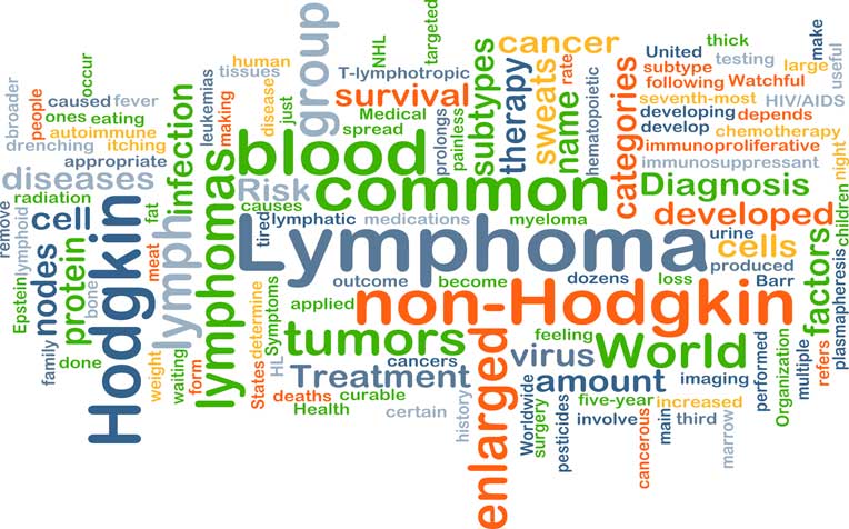 What is Lymphoma Cancer and the Symptoms