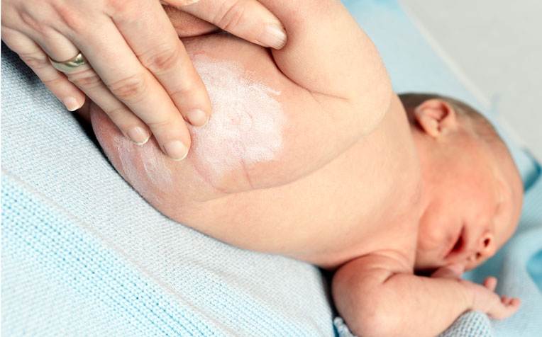 In severe cases, creams and ointments, topical steroids, and oral medication may be required to resolve baby skin conditions.