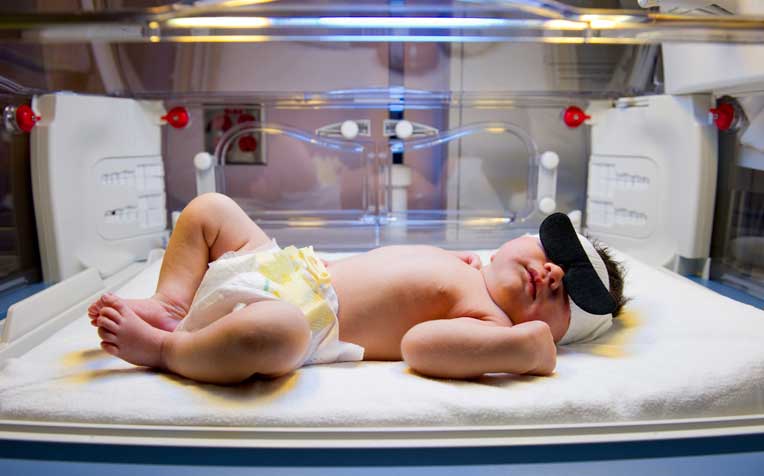 When jaundice is severe in newborn babies, phototherapy or even early surgery, may be recommended.