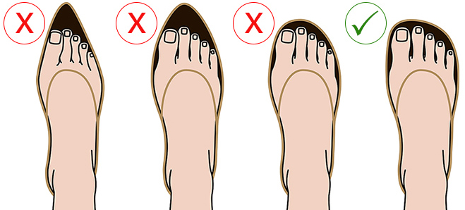 Avoid narrow-fitting shoes