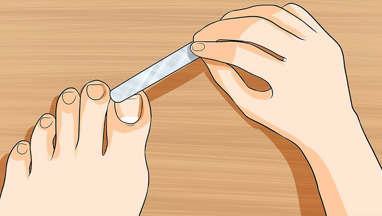 File toenails with a nail file