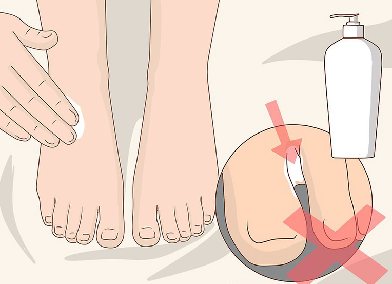 Avoid moisturising in between toes