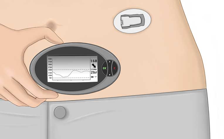 /sites/hexassets/Assets/diabetes/continuous-glucose-monitoring-blood-glucose-control.jpg