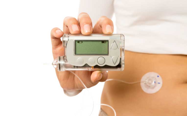 ​Diabetes: Portable Pump Gives Round-the-Clock Insulin
