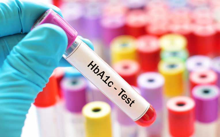 Hypoglycaemia: Is HbA1c a Good Indicator?