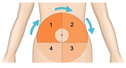 Insulin Injection Site Rotation Chart