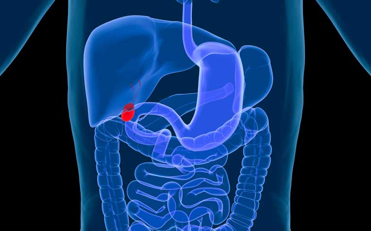 /sites/hexassets/Assets/digestive-system/are-you-at-risk-for-gallbladder-disease.jpg