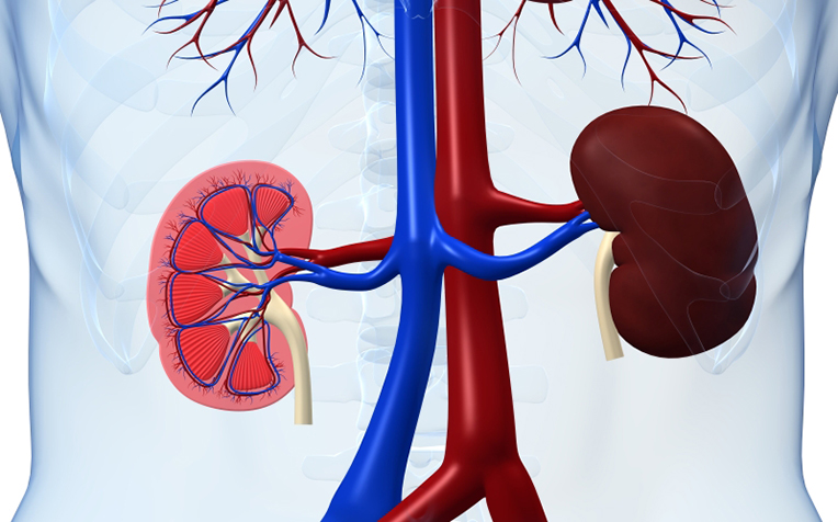 Glomerulonephritis: The Kidney Disease You Shouldn’t Ignore