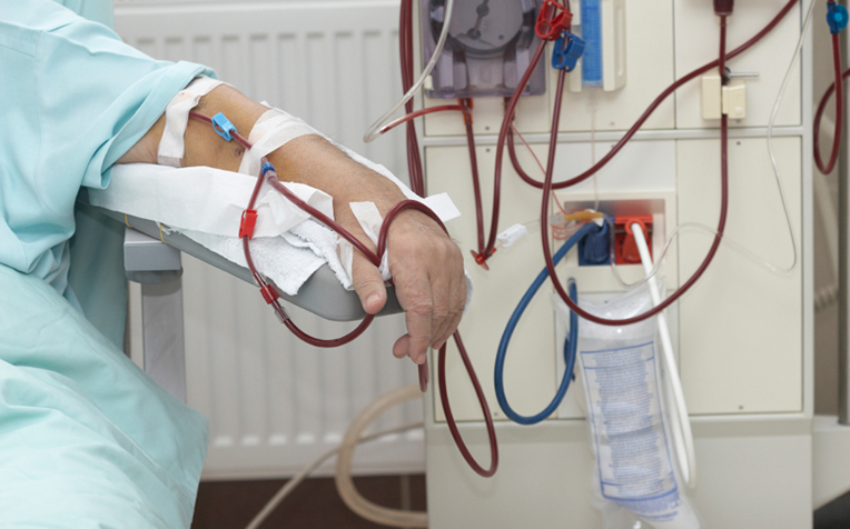  ​​Kidney Dialysis What You Should Know