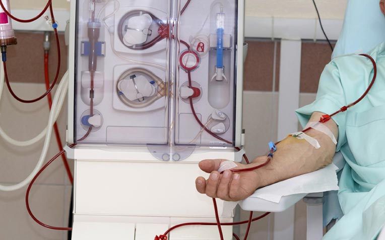 ​Kidney Failure Patients With High Antibodies May Now Get Transplant